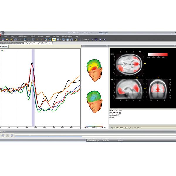 X는ӛ䛷ܛ EEG/ERP