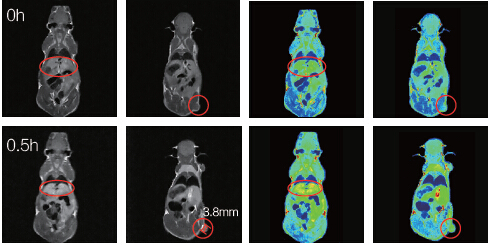 MRI(1T)СӋ(j)