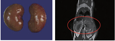 MRI(1T)СӋ(j)