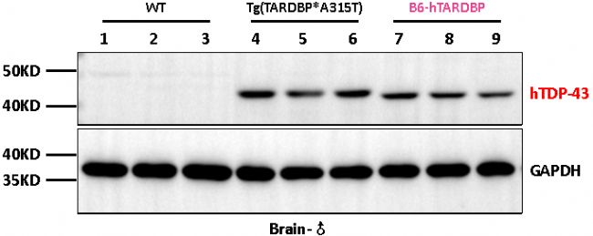 B6-hTARDBPС