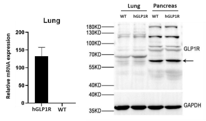 hGLP1RȫԴСģ